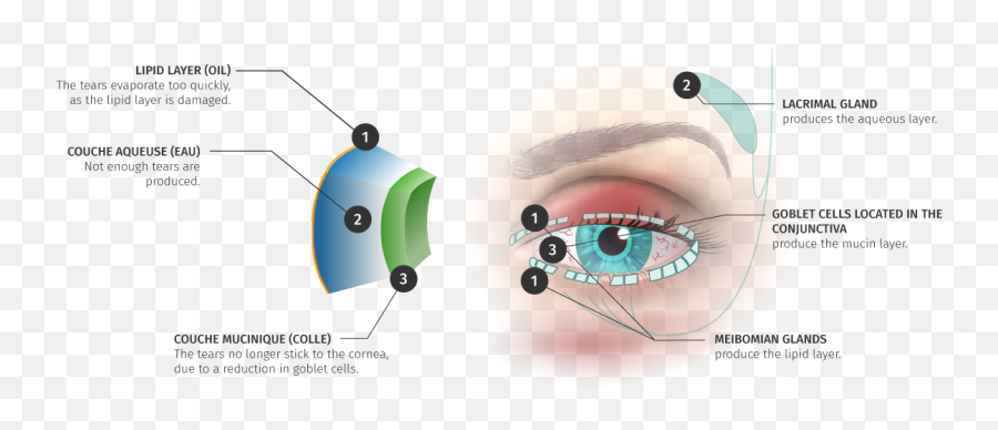 Dry Eye - Language Emoji,Different Tears Onions Vs Emotion