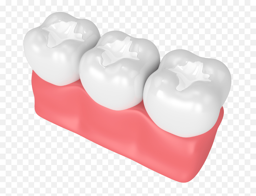 Pit And Fissure Sealants Fms Dental Hospital Emoji,Work Emotion 11r Gt Silver Wrx