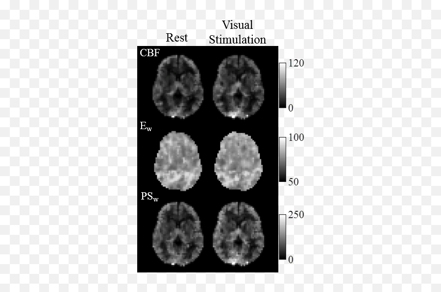 Ismrm19 Posters - Fmri Computed Tomography Emoji,What Images And Language Did Morrison Utilize To Evoke Emotion