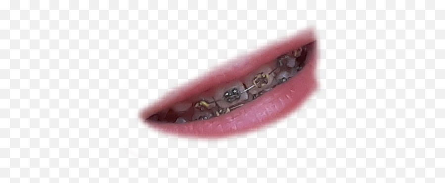 The Most Edited Braceface Picsart - Solid Emoji,Brace Face Emojis