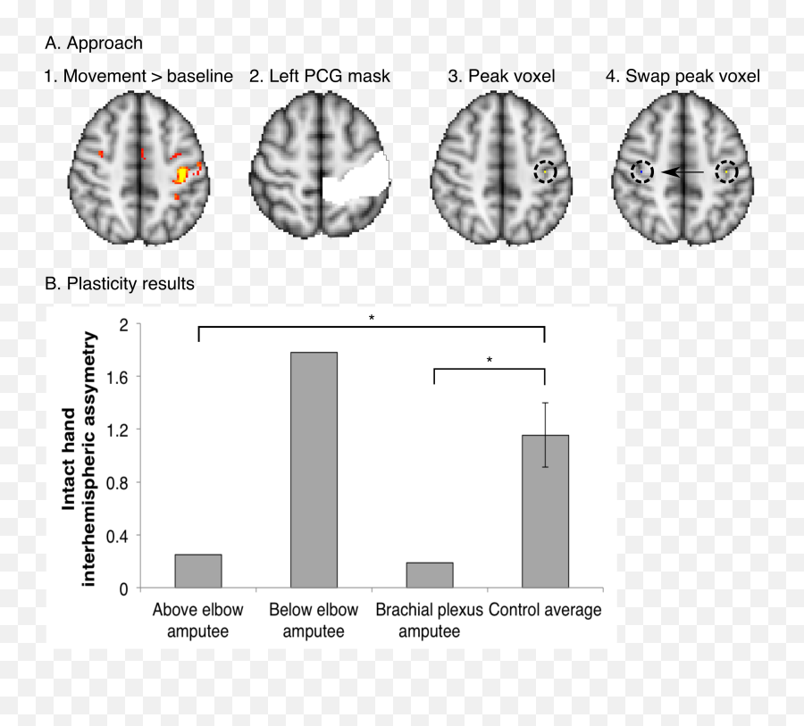 Browse By Ucl Departments And Centres - Ucl Discovery Dot Emoji,Lateralization Of Emotion Example