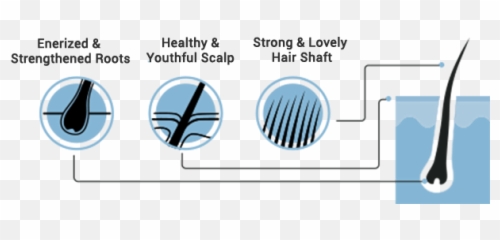 Hair Loss In Men - Vertical Emoji,Salon Emotion Loreal