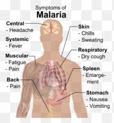 Wrong About Polio A Review Of Suzanne Humphries Md And - Malaria Symptoms Emoji,Periodic Table Of Emotions Wikipedia