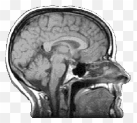 Research - Mri Brain White Background Emoji,Brain Scans Of Emotions