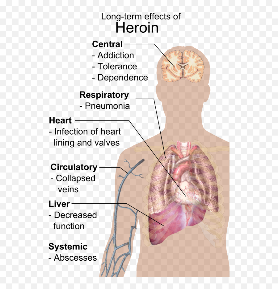 Cancer - Metastasis Symptoms Emoji,Gastric Cancer Nursing Diagnosis Emotion