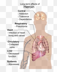 Cancer - Metastasis Symptoms Emoji,Gastric Cancer Nursing Diagnosis Emotion