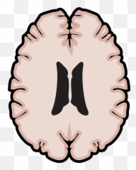 Graphic Brain Horizontal - Multiple Sclerosis Emoji,Brain Scans Of Emotions