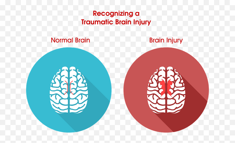 Traumatic Brain Injury - Know If You Have Brain Damage Emoji,Emotions Uncontrollable Mtbi