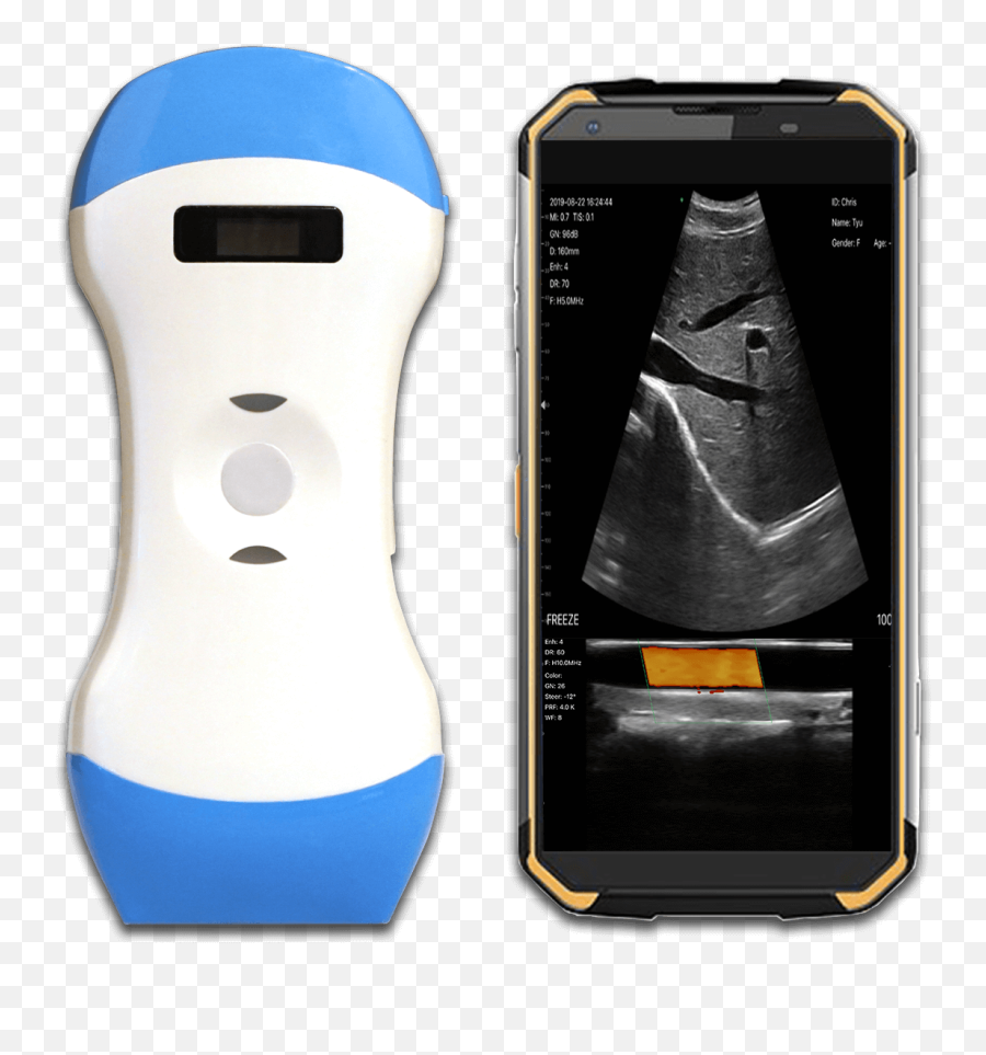 Ao Scanner U2013 The Future In Non - Invasive Digital Body Analysis Ao Scanner Emoji,Different Emotions Thermal Imaging Body