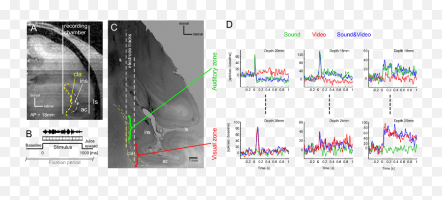 Auditory And Visual Zones In The Claustrum A Illustration - Plot Emoji,Medial Dorsal Nucleus Thalamus Memory Emotion Step 1