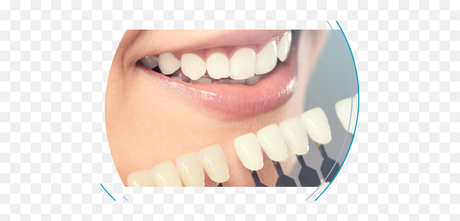 Cosmetic Dentistry - Cosmetic Teeth Emoji,Teeth Emotion