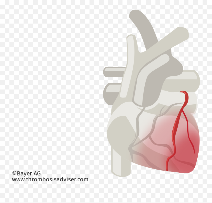 Download Cardiac Muscle Damage In Acs - Arterial Blood Gas Sign Language Emoji,Blood Emoji Png