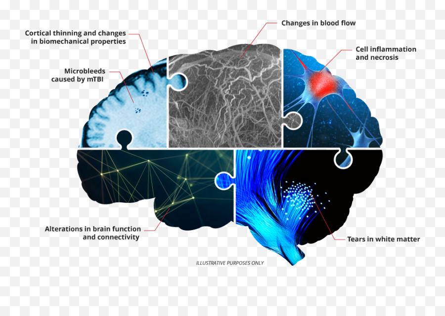 Concussion Mtbi - Dot Emoji,Emotions Uncontrollable Mtbi