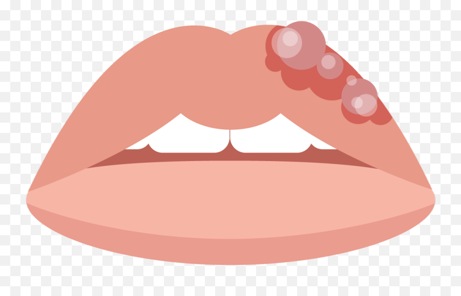 4 Common Triggers Of Cold Sores Fast - Cold Sore On Lip Emoji,Emotion Of Parsed Lips