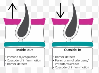 Atopic Dermatitis Overview - Inside Out And Outside In Eczema Table Emoji,G-major Emotions (inside Out)