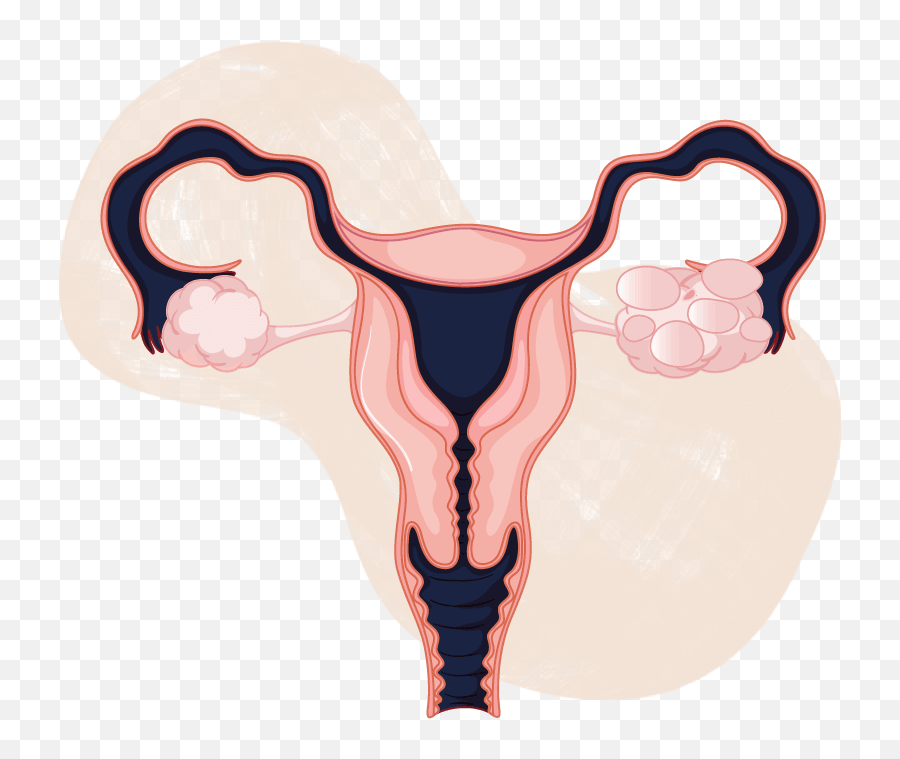 Polycystic Ovary - Ovarian Cancer Emoji,Entrance Ovary Emotion