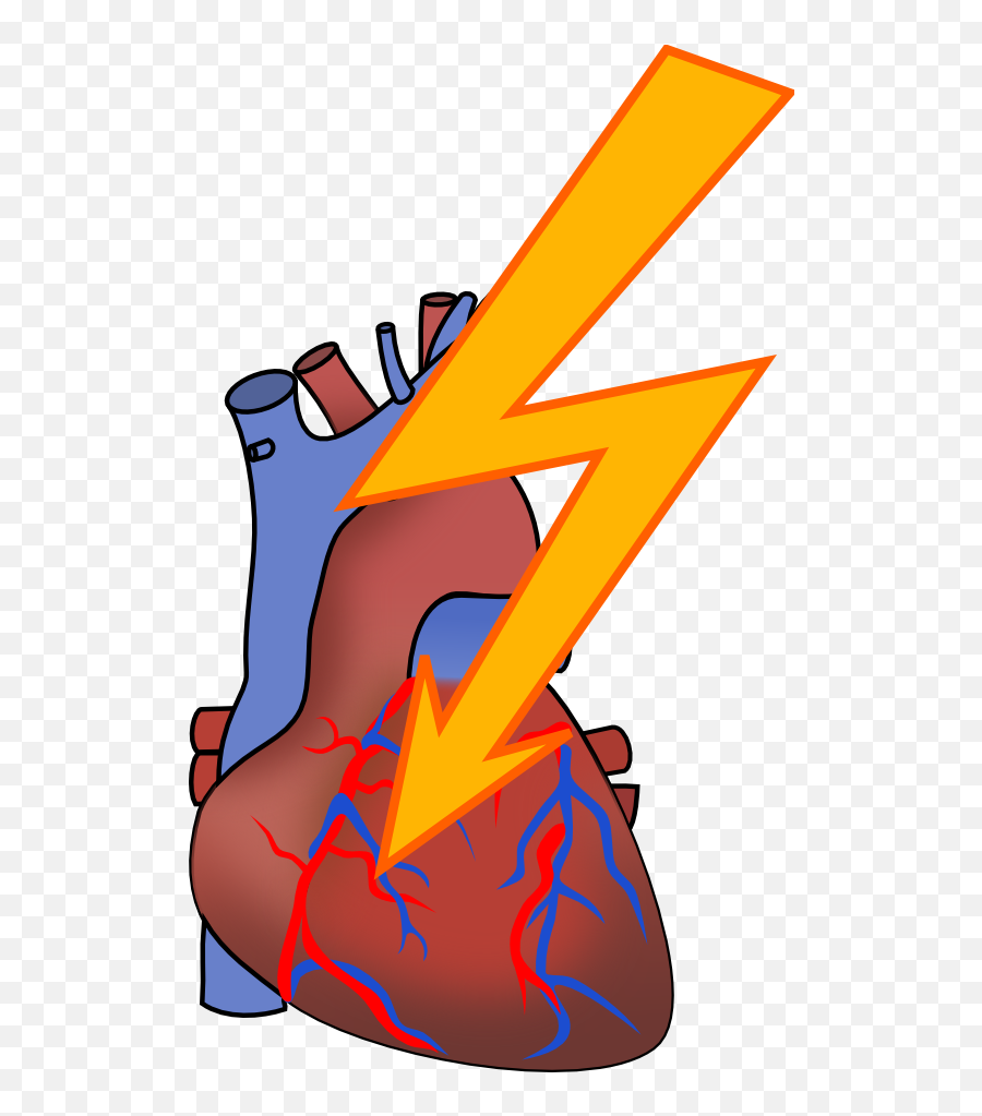 Free Heart Attack Clipart Download - Human Heart Clipart Emoji,Heart Attack Emoji