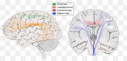 Cerebrum - Brain Emoji,Part Of Brain For Emotion