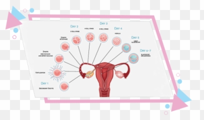 Blastocyst Culture Fertility Treatment - Kind Of Spotting Is Normal In Early Pregnancy Emoji,Work Emotion T7r Wheels Mgm