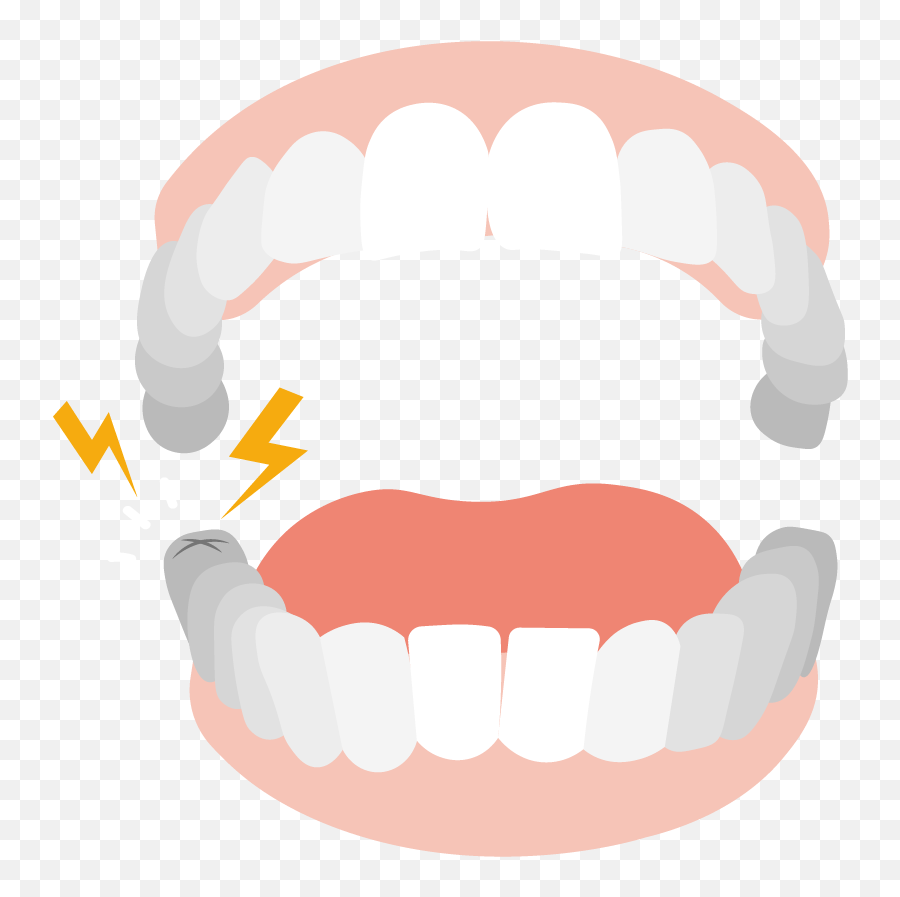 Molar Pain 5 Causes Of Molar Teeth Pain Treatment U0026 More Emoji,Meaning Of Tooth 32 And Emotions