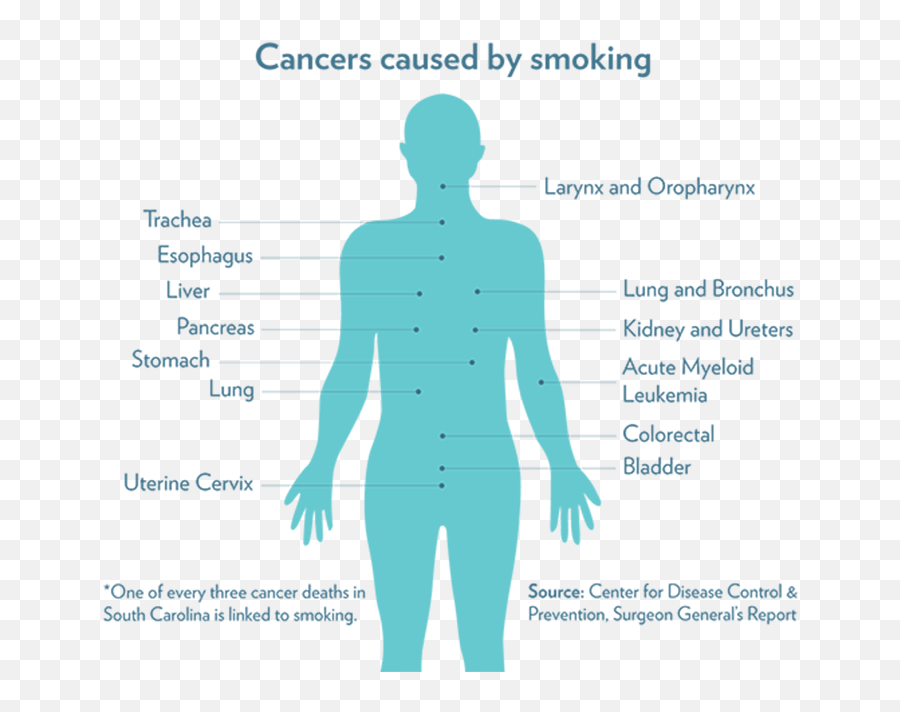 Hollings Cancer Center Expert On Smoking Cessation Offers - Standing Emoji,Gastric Cancer Nursing Diagnosis Emotion