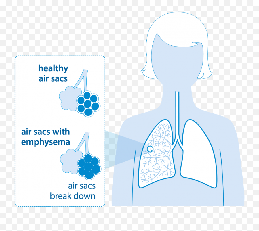 Emphysema British Lung Foundation Emoji,Emotion Of The Lungs