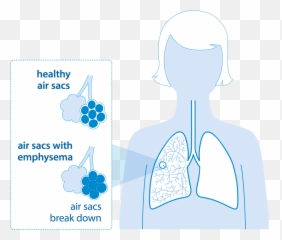 Emphysema British Lung Foundation Emoji,Emotion Of The Lungs
