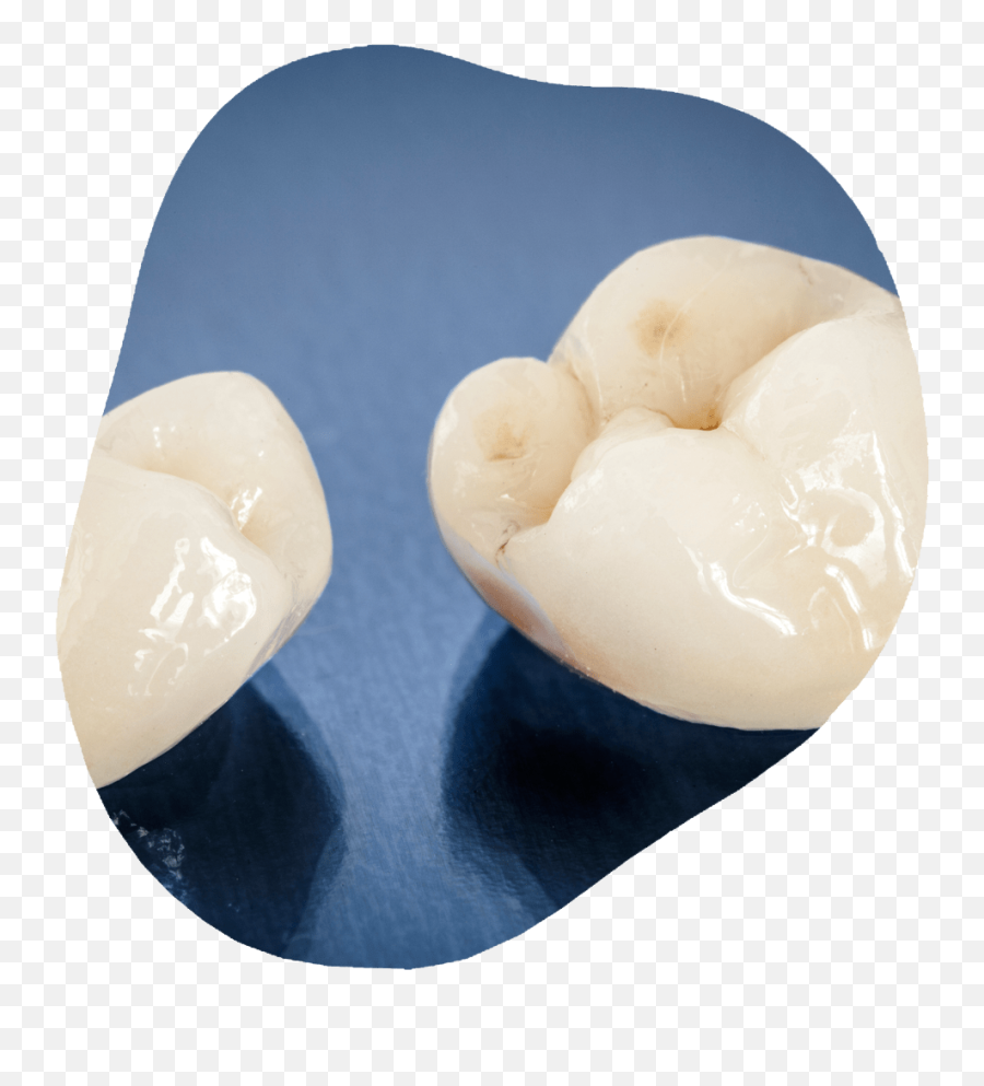 Dental Crowns Toothville Family Dentistry Nw Calgary Dentist Emoji,Hear Broken Emoji