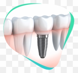 Home - Screw In Tooth Called Emoji,Teeth Emotion