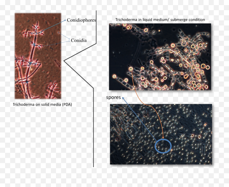 Questions With Answers In Trichoderma - Dot Emoji,Extra Emotion Fermental Time Questions With Answers In Trichoderma - Dot Emoji,Extra Emotion Fermental Time