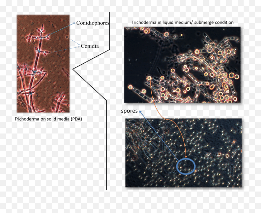 Questions With Answers In Trichoderma - Dot Emoji,Extra Emotion Fermental Time