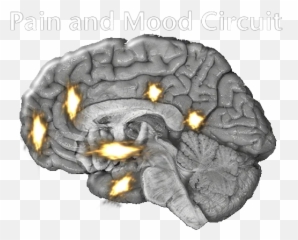 Shared Circuits - Areas Of The Brain Feel Pain Emoji,Emotion Circuit