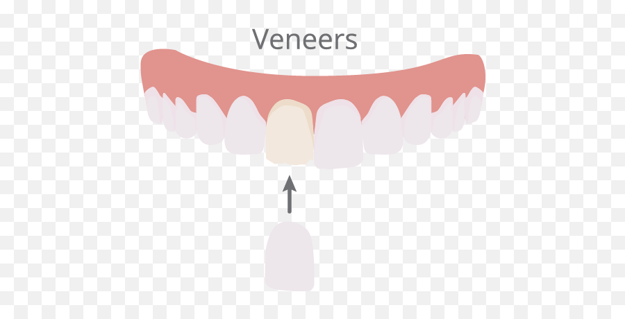 Cosmetic Dentist In Torrance Ca - Dental Cosmetic Veneers Design Emoji,Teeth And Emotions