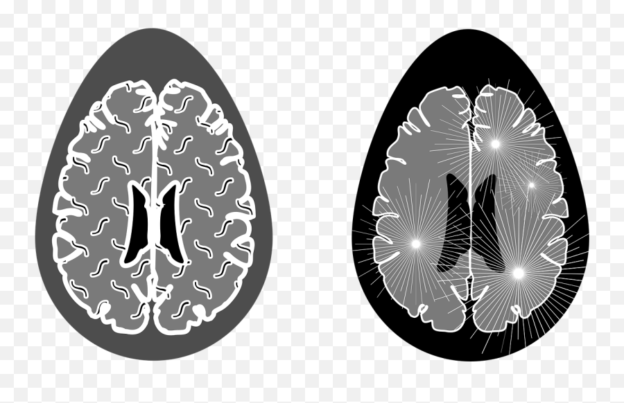 Alzheimeru0027s Disease Can Be Influenced By Your Diet Find Out Emoji,Biphasic Model Of Emotion