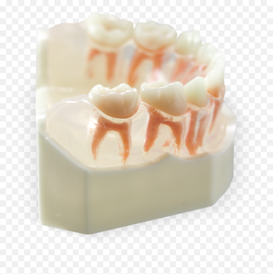 Acadental - Dental Study Model Primary Teeth Emoji,Meaning Of Tooth 32 And Emotions
