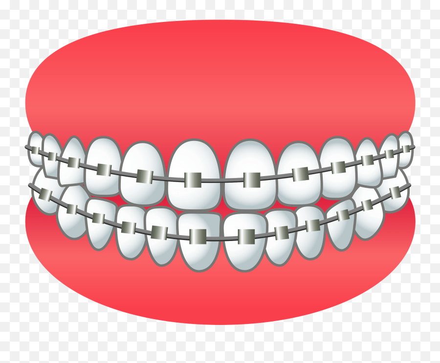 Dental Braces Clipart Free Download Transparent Png - Braces Clipart Png Emoji,Text Emoticons With Brackets