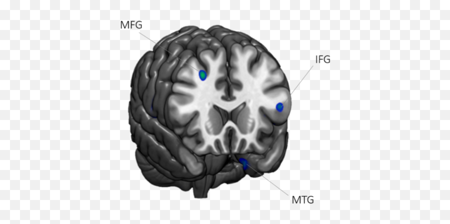 Publications - Brain Emoji,Mtg White Emotion