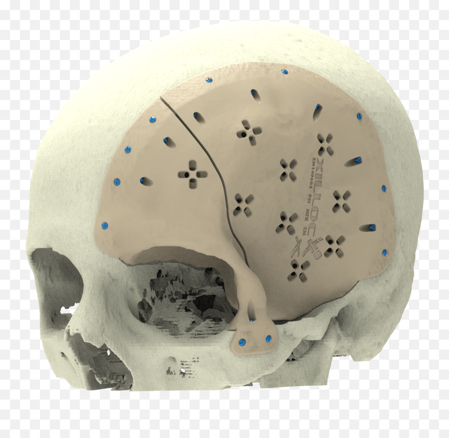 Custom Implants Xilloc Emoji,Skulls That Can Show Emotion