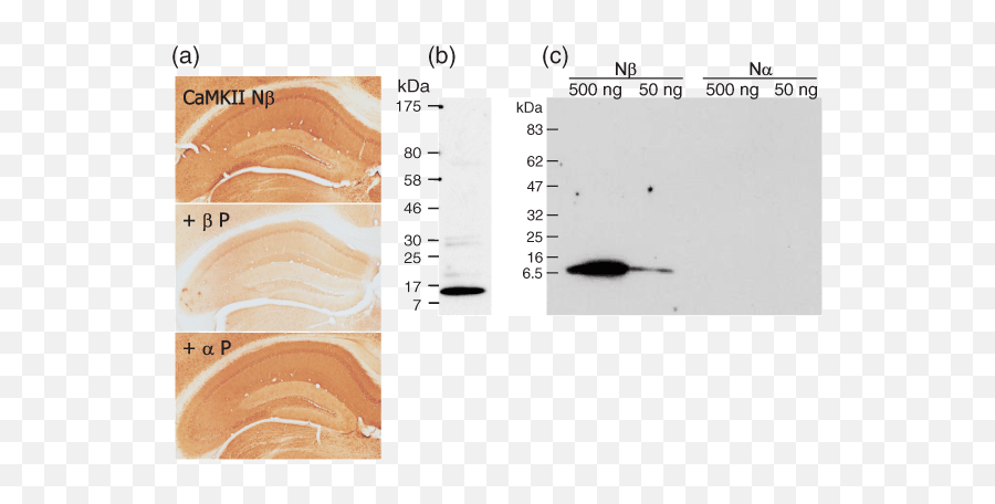 Differential Regulation Of Camkii Inhibitor Protein - Dry Emoji,Ledoux Model Of Emotion