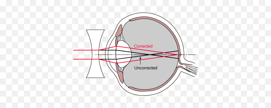 Under Eye Diagram Diagram Base Website Eye Diagram Emoji,Csr2 Emojis