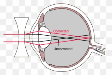 Under Eye Diagram Diagram Base Website Eye Diagram Emoji,Csr2 Emojis