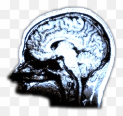 Company Action Potential Productions Emoji,Brain Scan Of Emotions