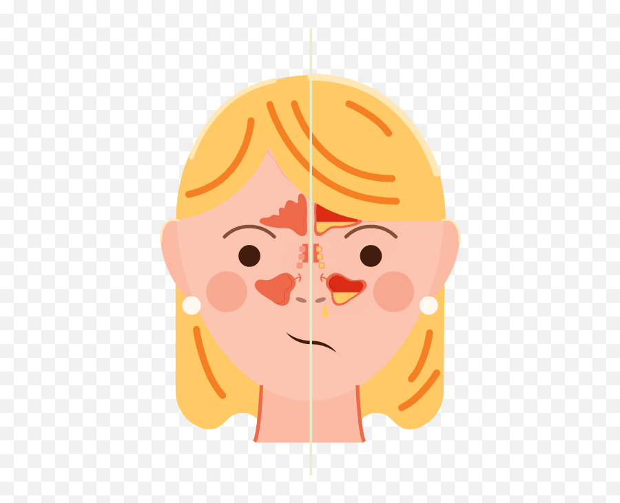 Las Alergias Pueden Causar Dolor De - Dolor Facial Por Alergia Emoji,Que Significa El Emoticon De La Monita Con Brazos Sobre La Cabesa