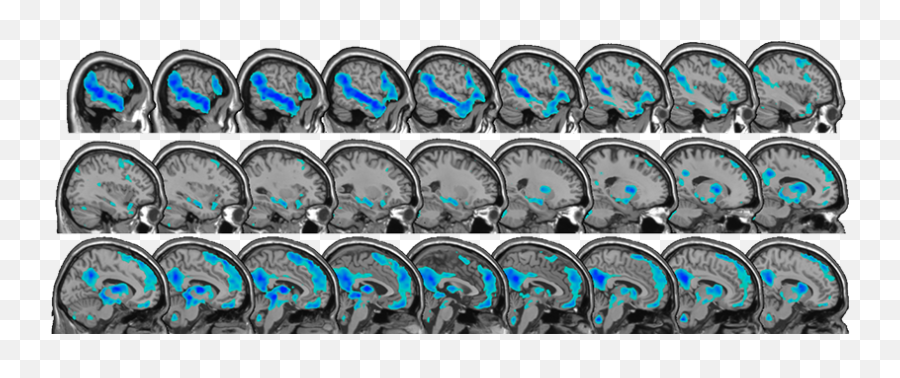 John Gabrieli Archives - Mit Mcgovern Institute Emoji,Brain Scans Of Emotions