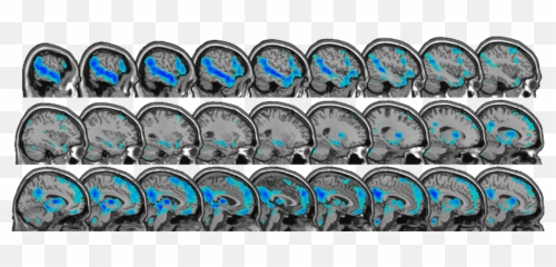John Gabrieli Archives - Mit Mcgovern Institute Emoji,Brain Scans Of Emotions
