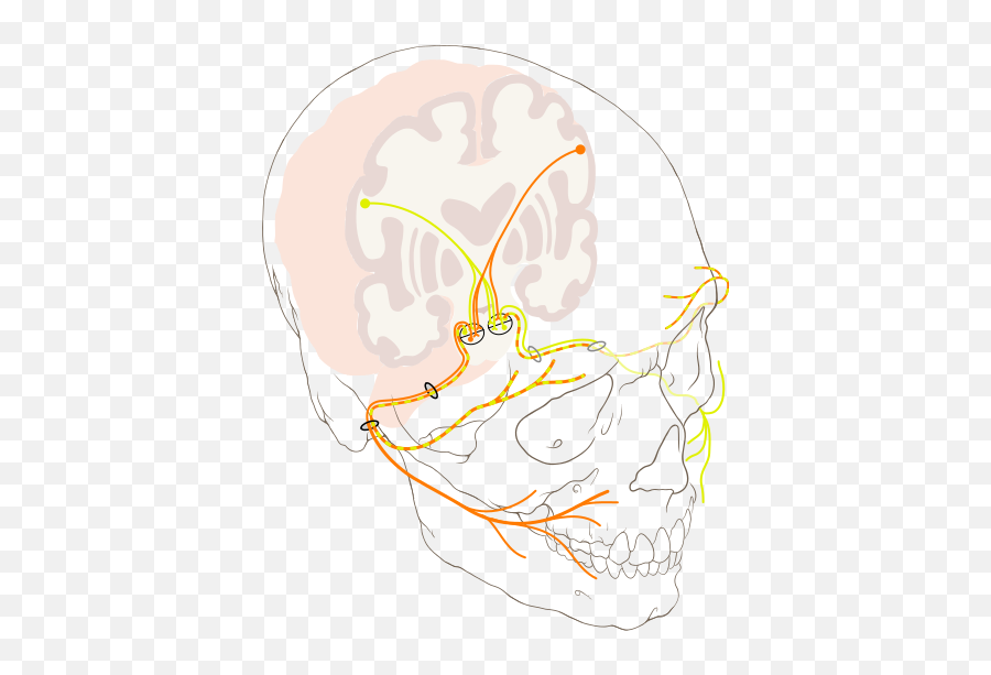 Filecranial Nerve Vii Bells Palsypng - Physiopedia Emoji,Face And Emotion Skull