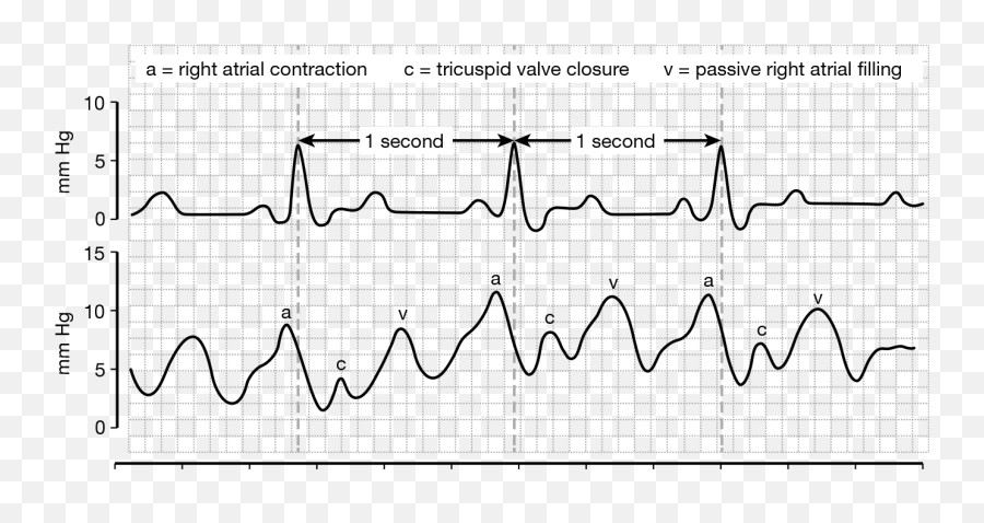 Cardiovascular System Springer Publishing - Plot Emoji,Graphics, Emotion Code, Heart Wall