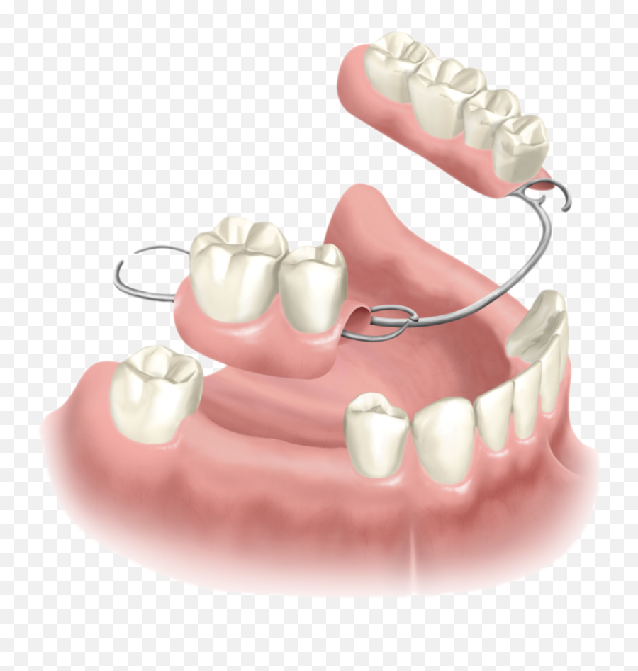 Dentures - Major Dental Care West Los Angeles Dentistry Emoji,Meaning Of Tooth 32 And Emotions