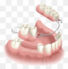Dentures - Major Dental Care West Los Angeles Dentistry Emoji,Meaning Of Tooth 32 And Emotions