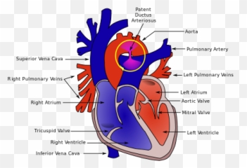 Terjual Pengenalan Tentang Penyakit Jantung Bawaan - Patent Ductus Arteriosus Emoji,Emoticon Parman